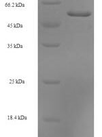 Human Septin-2 (SEPT2) Recombinant Protein - BioCrest Sci
