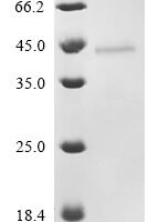 Human adenovirus C serotype 2 Early E4 34 kDa protein Recombinant Protein - BioCrest Sci