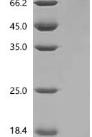Human Glycylpeptide N-tetradecanoyltransferase 1 (NMT1) Recombinant Protein - BioCrest Sci
