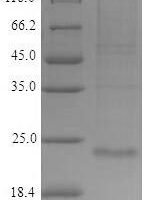 Human RING finger protein 11 (RNF11) Recombinant Protein, C-9xHis - BioCrest Sci