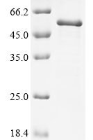 Human Proto-oncogene c-Fos (Fos) Recombinant Protein - BioCrest Sci