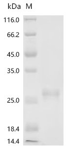 Rat Beta-nerve growth factor (Ngf) Recombinant Protein, N-His/C-His, Rattus norvegicus (Rat), E.coli, N-terminal 6xHis-tagged and C-terminal 6xHis-tagged, 23.4 kDa, purity >≥ 95% as determined by SDS-PAGE.