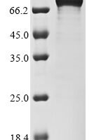 Human B-cell lymphoma 6 protein (BCL6) Recombinant Protein - BioCrest Sci