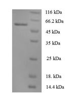 Human Angiopoietin-1 (ANGPT1) Recombinant Protein, Homo sapiens (Human), E.coli, N-terminal 6xHis-tagged, 59.9 kDa, purity >≥ 90% as determined by SDS-PAGE.