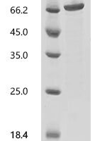 Human Ubiquitin fusion degradation protein 1 homolog (UFD1L) Recombinant Protein, C-GST - BioCrest Sci