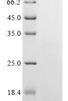 Human Large neutral amino acids transporter small subunit 4 (SLC43A2), partial Recombinant Protein - BioCrest Sci