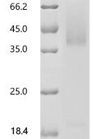 Human Solute carrier organic anion transporter family member 1A2 (SLCO1A2),partial Recombinant Protein, N-His-SUMOstar - BioCrest Sci