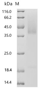 Human Solute carrier organic anion transporter family member 1A2 (SLCO1A2),partial Recombinant Protein, N-His-SUMOstar, Homo sapiens (Human), Yeast, N-terminal 6xHis-sumostar-tagged, 24.6 kDa, purity >≥ 90% as determined by SDS-PAGE.