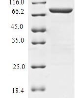 Mouse Beta-adrenergic receptor kinase 1 (Grk2) Recombinant Protein, N-His-B2M - BioCrest Sci