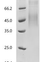 Dog CD274 molecule (PDL1), partial Recombinant Protein - BioCrest Sci