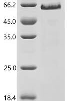 Human Neurogenic locus notch homolog protein 1 (NOTCH1), partial Recombinant Protein, C-10His - BioCrest Sci