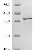Saccharomyces cerevisiae NADPH-dependent methylglyoxal reductase GRE2 (GRE2) Recombinant Protein - BioCrest Sci