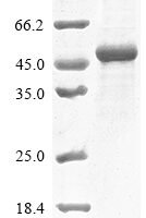 Human Collagen alpha-2 (IV) chain (COL4A2), partial Recombinant Protein, N-10His - BioCrest Sci