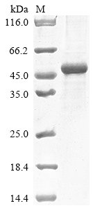 Human Collagen alpha-2 (IV) chain (COL4A2), partial Recombinant Protein, N-10His, Homo sapiens (Human), Baculovirus, N-terminal 10xHis-tagged, 48.6 kDa, purity >≥ 85% as determined by SDS-PAGE.