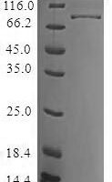 Human Tyrosine-protein kinase BTK (BTK) Recombinant Protein, N-10His - BioCrest Sci