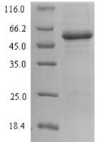 Escherichia coli Lactose operon repressor (lacI) Recombinant Protein - BioCrest Sci