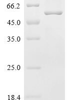 Chlamydophila psittaci Major outer membrane porin (ompA) Recombinant Protein, N-His-KSI - BioCrest Sci