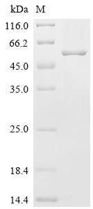 Chlamydophila psittaci Major outer membrane porin (ompA) Recombinant Protein, N-His-KSI, Chlamydophila psittaci (strain ATCC VR-125 / 6BC) (Chlamydia psittaci), E.coli, N-terminal 6xHis-KSI-tagged, 56.3 kDa, purity >≥ 85% as determined by SDS-PAGE.