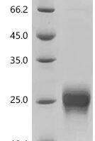 Mouse Interleukin-2 (Il2) Recombinant Protein, N-10His - BioCrest Sci