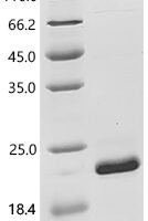 Human NADH dehydrogenase [ubiquinone] iron-sulfur protein 6, mitochondrial (NDUFS6) Recombinant Protein - BioCrest Sci