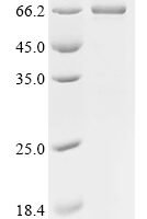 Dog Albumin (ALB), Biotinylated Recombinant Protein - BioCrest Sci