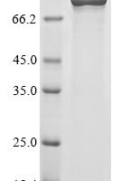 Escherichia coli Outer membrane protein assembly factor BamA (BamA) Recombinant Protein - BioCrest Sci