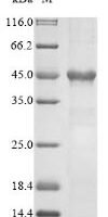 Human Frataxin, mitochondrial (FXN) Recombinant Protein - BioCrest Sci