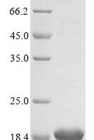 Mouse Beta-synuclein (Sncb) Recombinant Protein - BioCrest Sci