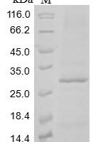 Mouse C-type lectin domain family 12 member A (Clec12a), partial Recombinant Protein, N-10His/C-Myc, aa 65–267, Baculovirus - BioCrest Sci