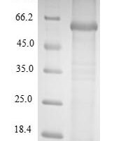 BK polyomavirus Major capsid protein VP1 Recombinant Protein, N-10His-SUMO/C-Myc - BioCrest Sci