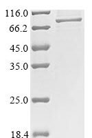 Rabbit Dystroglycan (DAG1), partial Recombinant Protein - BioCrest Sci