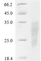 Rabbit Coagulation factor VII (F7), partial Recombinant Protein, C-His, aa 40–191, Mammalian cell - BioCrest Sci