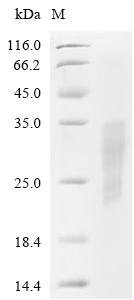 Rabbit Coagulation factor VII (F7), partial Recombinant Protein, C-His, aa 40–191, Mammalian cell, Mammalian cell, C-terminal 6xHis-tagged, 19.3 kDa, purity >≥ 95% as determined by SDS-PAGE.