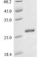 Human Choline/ethanolaminephosphotransferase 1 (CEPT1), partial Recombinant Protein - BioCrest Sci