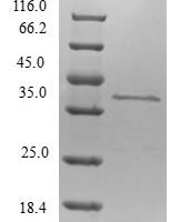Human p53-regulated apoptosis-inducing protein 1 (TP53AIP1) Recombinant Protein - BioCrest Sci