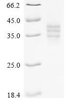 Mouse Lymphocyte antigen 6D (Ly6d) Recombinant Protein - BioCrest Sci