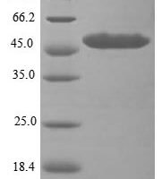 Human ATP-dependent RNA helicase DHX33 (DHX33), partial Recombinant Protein - BioCrest Sci