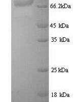 Bacillus thuringiensis subsp. Pesticidal crystal protein cry3Aa (cry3Aa) Recombinant Protein - BioCrest Sci