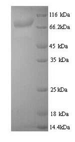 Bacillus thuringiensis subsp. Pesticidal crystal protein cry3Aa (cry3Aa) Recombinant Protein, Bacillus thuringiensis subsp. tenebrionis, Yeast, N-terminal 6xHis-tagged, 68.5 kDa, purity >≥ 90% as determined by SDS-PAGE.
