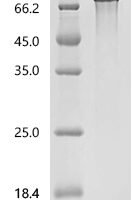 Mouse Programmed cell death 1 ligand 1 (Cd274), partial Recombinant Protein - BioCrest Sci