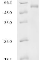 Human Tyrosinase (TYR), partial Recombinant Protein, C-His - BioCrest Sci