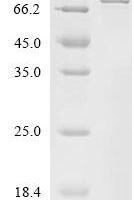 Human Calcium uptake protein 1, mitochondrial (MICU1) Recombinant Protein - BioCrest Sci