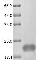 Staphylococcus aureus Phenol-soluble modulin alpha 1 peptide (psmA1) Recombinant Protein, N-His-SUMOstar - BioCrest Sci