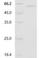 Human Plexin domain-containing protein 1 (PLXDC1), partial Recombinant Protein, N-His - BioCrest Sci