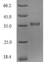 Pseudomonas aeruginosa Protease LasA (lasA) Recombinant Protein - BioCrest Sci