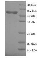 Human Bone morphogenetic protein receptor type-1A (BMPR1A), partial Recombinant Protein - BioCrest Sci