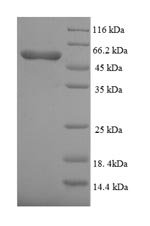 Human Bone morphogenetic protein receptor type-1A (BMPR1A), partial Recombinant Protein, Homo sapiens (Human), E.coli, N-terminal 6xHis-SUMO-tagged, 56.6 kDa, purity >≥ 90% as determined by SDS-PAGE.
