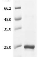 Bovine Ribonuclease 4 (RNASE4) Recombinant Protein - BioCrest Sci