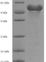 Human Kynurenine/alpha-aminoadipate aminotransferase, mitochondrial (AADAT) Recombinant Protein, N-His-SUMO - BioCrest Sci