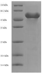 Human Kynurenine/alpha-aminoadipate aminotransferase, mitochondrial (AADAT) Recombinant Protein, N-His-SUMO, Homo sapiens (Human), E.coli, N-terminal 6xHis-SUMO-tagged, 60.2 kDa, purity >≥ 90% as determined by SDS-PAGE.